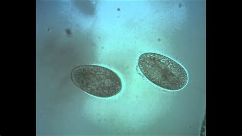 Two Ciliate Cells After To Complete Binary Division YouTube