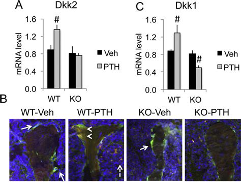 PTH Differentially Regulated Dkk2 And Dkk1 MRNA In Bones Of WT And