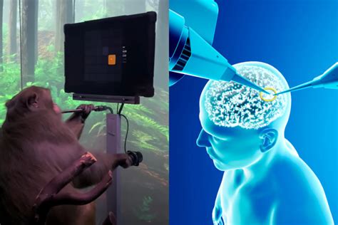 Neuralink Ya Puede Implantar Chips Cerebrales En Humanos La Empresa De