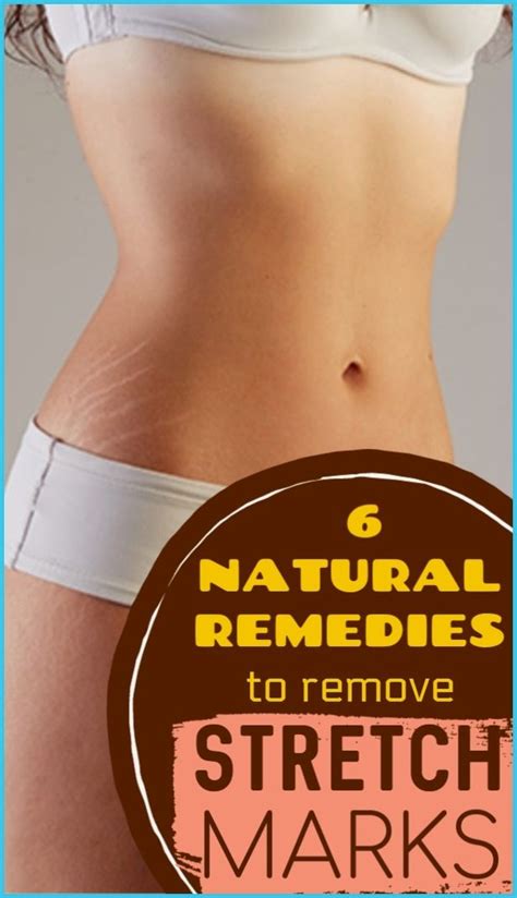 Remove Stretch Marks Fast With These 6 Natural Remedies Care For