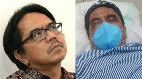 Update Kondisi Ade Armando Setelah Dikeroyok Massa Di Depan Gedung Dpr