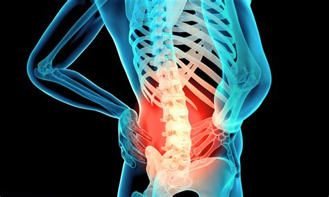 Low Back Pain Relief How Peripheral Nerve Stimulation Can Help