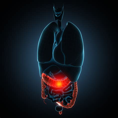 Combined Immunotherapy May Work for Certain Colorectal Cancer