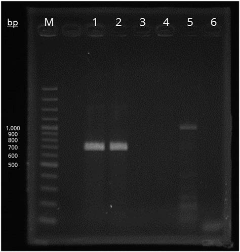 Photograph Of Ethidium Bromide Stained Agarose Gel Showing The Pcr