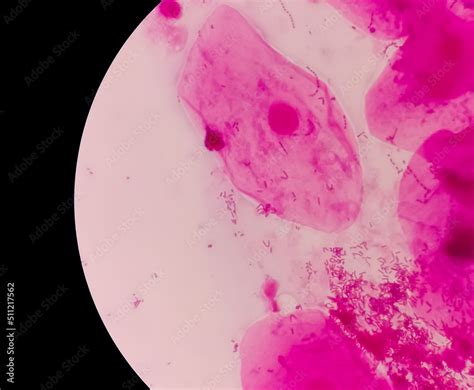 Prostatic Smear Ps Gram Stain Microscopic X Show Epithelial Cells