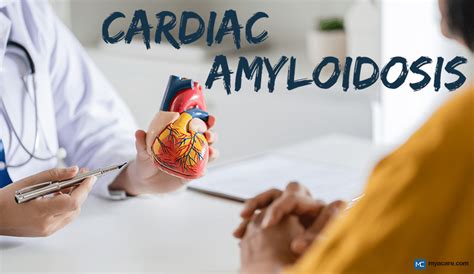 What You Need To Know About Stiff Heart Syndrome Cardiac Amyloidosis Mya Care U Myacare