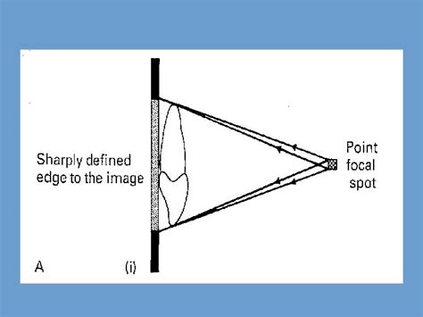 Factors affecting the radiographic image and film faults