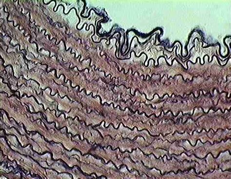 Elastic Connective Tissue Histology