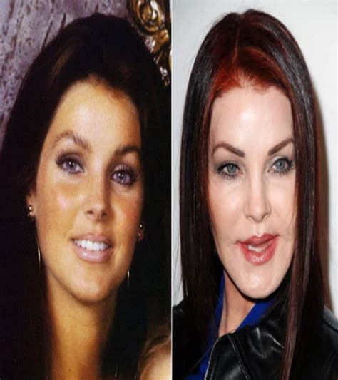 Worst Cases Of Celebrity Plastic Surgery Gone Wrong