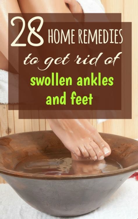 Home Remedy Hacks • 28 Home Remedies For Feet And Ankle Swelling