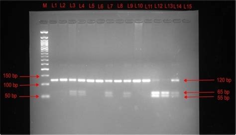 Pcr Rflp Of Esr Gene Using Pvu Ii M Bp Marker L Pcr Rflp