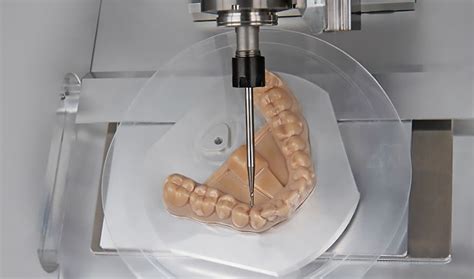 Clear Aligners MediMatch Dental Laboratory