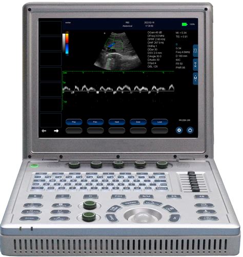 Color Doppler Ultrasound Portable