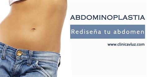 Abdominoplastia O Cirug A Del Abdomen Cl Nicas Vitaluz