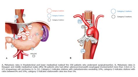 Mapping Of Lymph Node Metastasis From Esophagogastric Junction Tumors