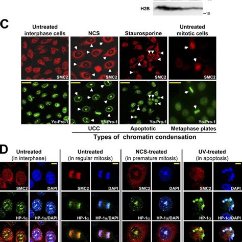 Dna Damage Triggers The Recruitment Of Condensin Core Subunits To