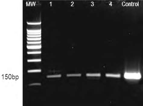 Gel Electrophoresis For E6 Hpv16 Mw Molecular Weight Marker 1234 Download Scientific