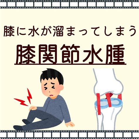 膝に水が溜まってしまう『膝関節水腫』 そら鍼灸接骨院 ジョイフル本田 千葉ニュータウン店