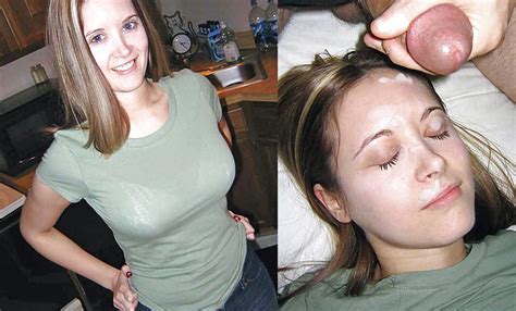 Before And After Facial Porn Pictures Xxx Photos Sex Images