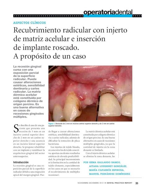 Pdf Recubrimiento Radicular Con Injerto De Matriz Acelular E