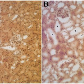 Western Blots Of Hypoxia Inducible Factor Hif And Toll Like