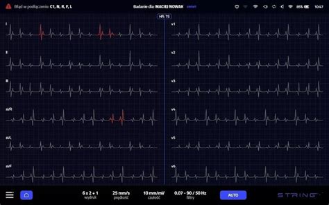 Opus Aparat Ekg Elektrokardiograf Elektrokardiografia Gabinet