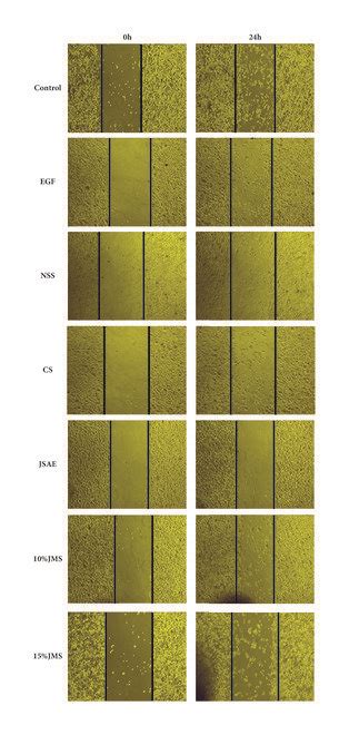 Jsae Inhibits Migration Of Sw480 Cells Demonstrated By Scratch Assay Download Scientific