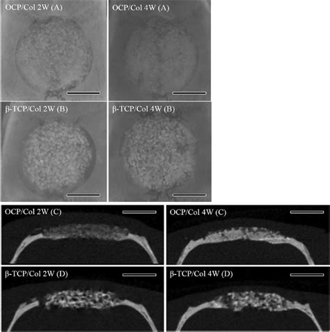 Radiographic Examination And Micro Computed Tomography Ct Of