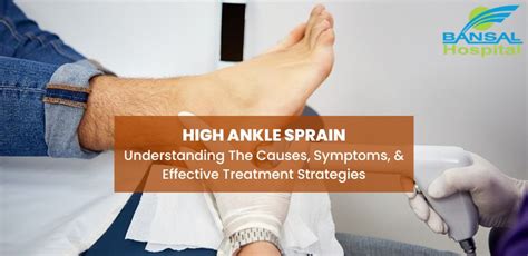 High Ankle Sprain Understanding Causes Symptoms Bansal Hospital