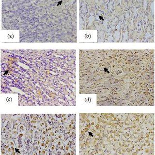 Immunohistochemical Staining Of Sox Expression X Magnification