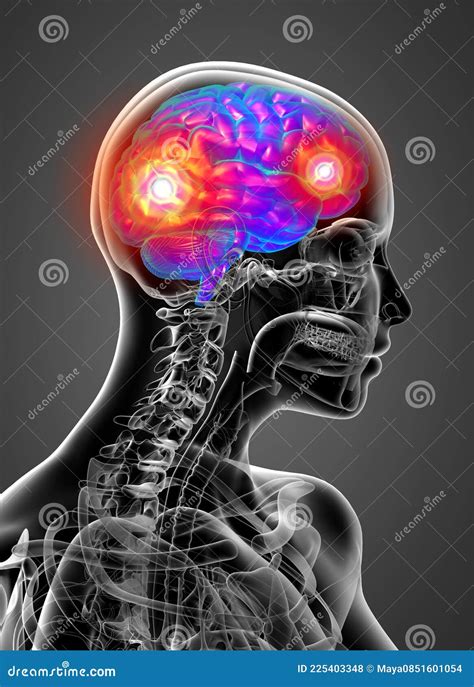 D Render Medical Illustration Of The Human Brain Stock Illustration