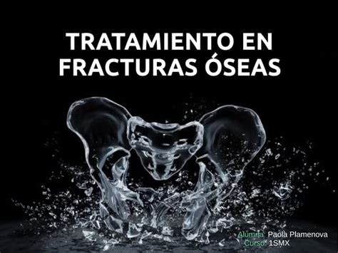 Tratamiento En Fracturas óseas Ppt