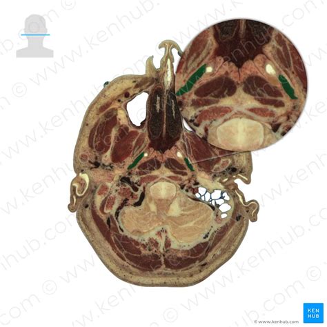 Levator Veli Palatini Origin Insertion And Action Kenhub