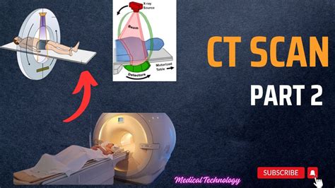 Working Principle Of Ct Scan Ct Scan Procedure Medical Technology