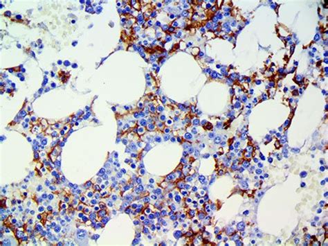 CD16 Antibody (EP364) - Bio SB