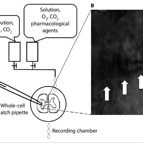 Schema Of The Patch Clamp Technique In Vitro The Specimen Slice Is