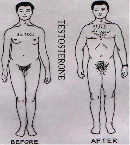 Michael Noble Representations Of Klinefelter Syndrome Intersex Human