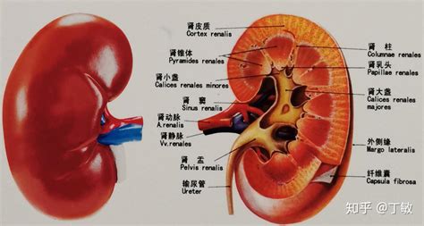 肾结石及治疗攻略 良心分享成因症状对策案例 知乎