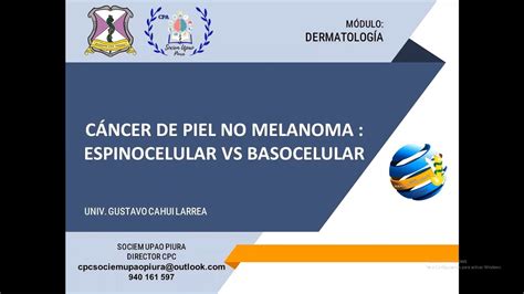 Carcinoma Basocelular Y Epidermoide Sociem Upao Piura Youtube