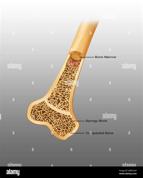 Spongy bone hi-res stock photography and images - Alamy