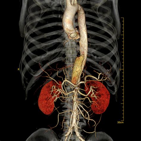 Neuviz Prime Ct Neusoft Medical