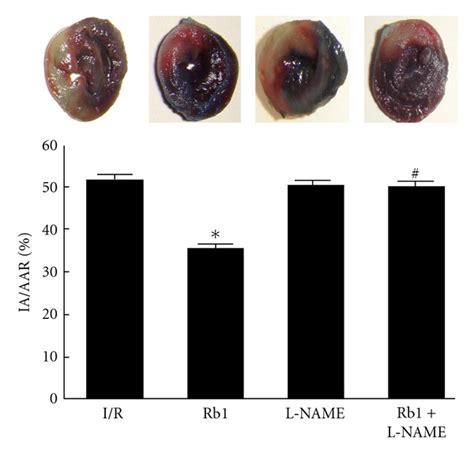 Infarct Size Expressed As Percent Of The Area At Risk In Rats Subjected