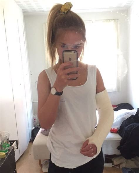 Pin De Alex Schneider Em Long Arm Cast Lac