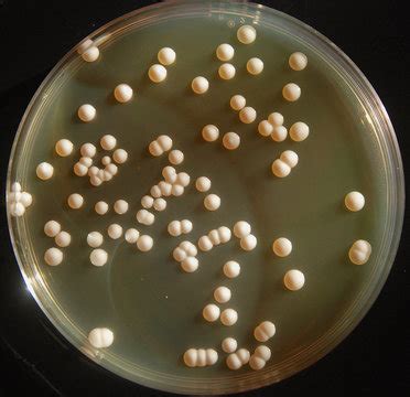 Saccharomyces Cerevisiae Yeast