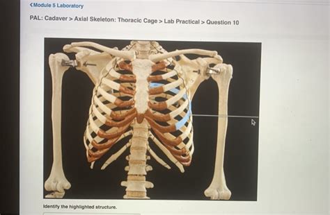 Solved Axial Skeleton Thoracic Cage Lab Practical Chegg