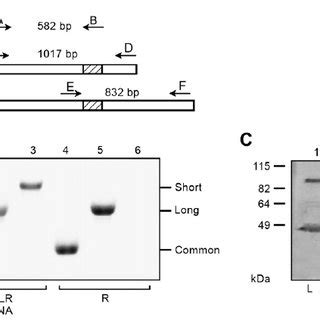 Expression Of PRLR In Rat Retina A Schematic Representation Of