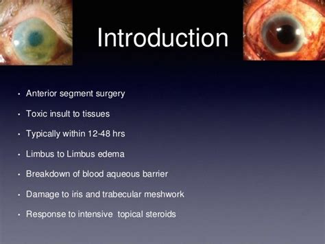 Causes Of Toxic Anterior Segment Syndrome