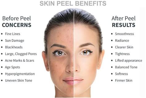 Chemical Peels An Ultimate Guide To Skin Rejuvenation At Pure Med Spa Medford Oregon Pure