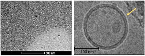 High-resolution Cryo-TEM images of liposomes [146]. | Download ...