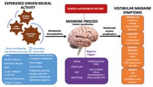 Vestibular Migraine ACNR